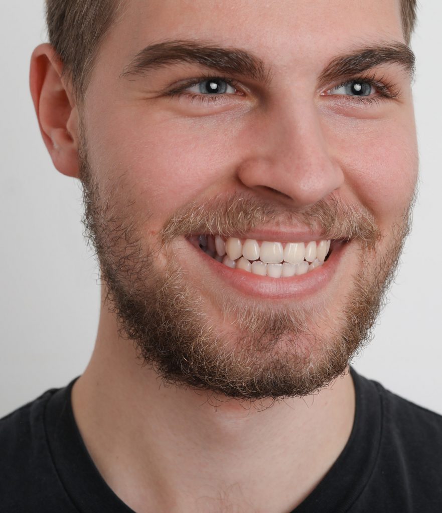 Zobna estetika - Topzob